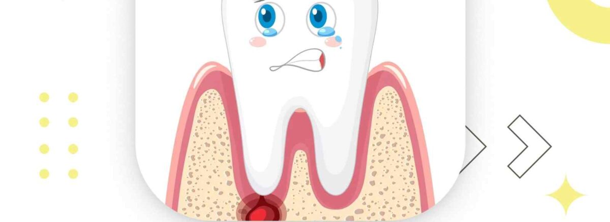 best treatments for gum disease
