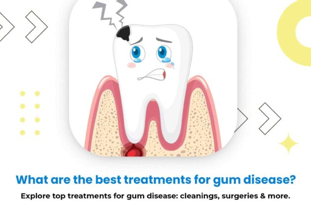 best treatments for gum disease