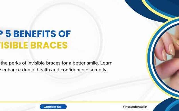 Benefits of Invisible Braces