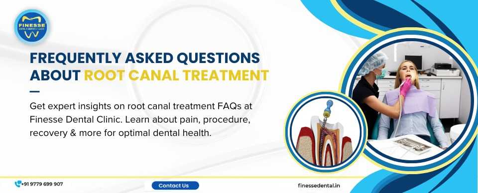 faqs Root Canal Treatment