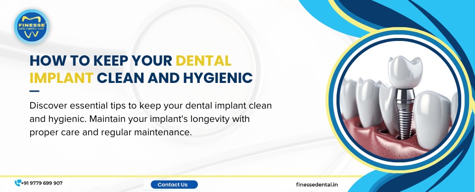 How to Keep Your Dental Implant Clean