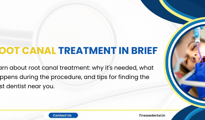 Root canal treatment in brief