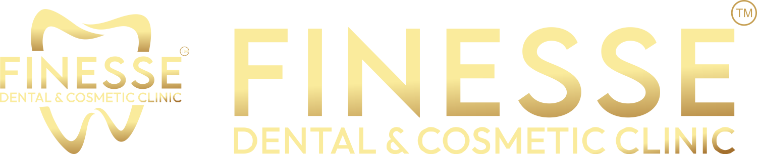 Finesse_Dental-logo